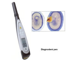 DIAGNODENT PEN KAVO 2190 APPARECCHI