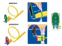 CENTRATORE H.N. ENDOBITE SENSO 2900 KIT ASSORTITO