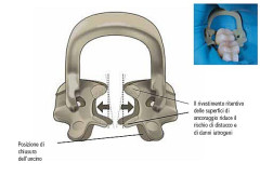 UNCINI KERR SOFT CLAMP 5250 KIT