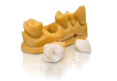 BEGO VARSEOSMILE CROWN PLUS A1 250GR            41117